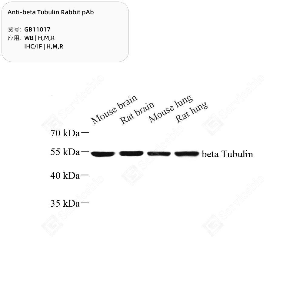 항베타 튜불린 토끼 pAb, 튜불린 베타-5 사슬(Tubulin beta-5 chain)항체, GB11017-100, Anti -beta Tubulin Rabbit pAb