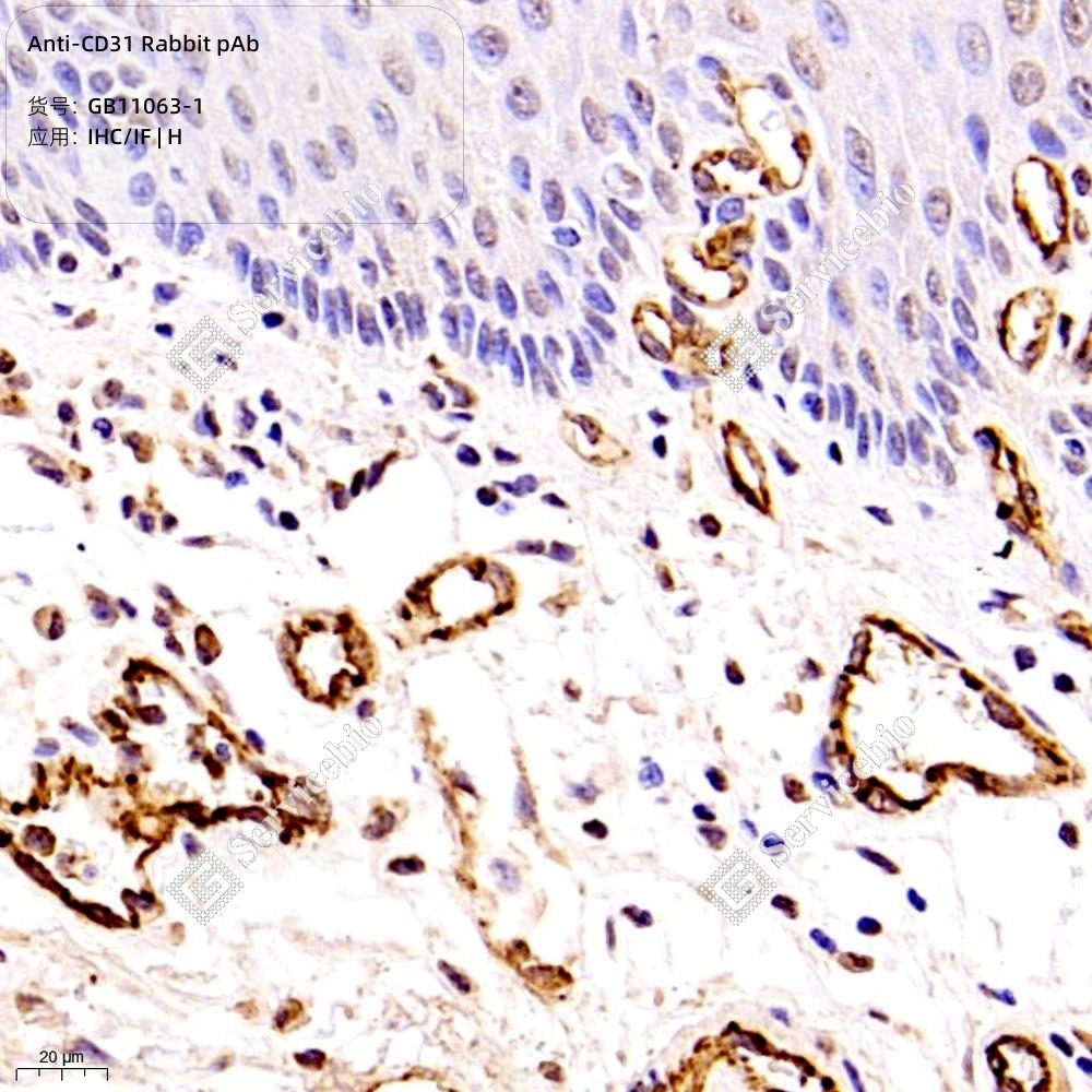 CD31 토끼 다클론 항체, GB11063-1, GB11063-1-100, Anti-CD31 Rabbit pAb